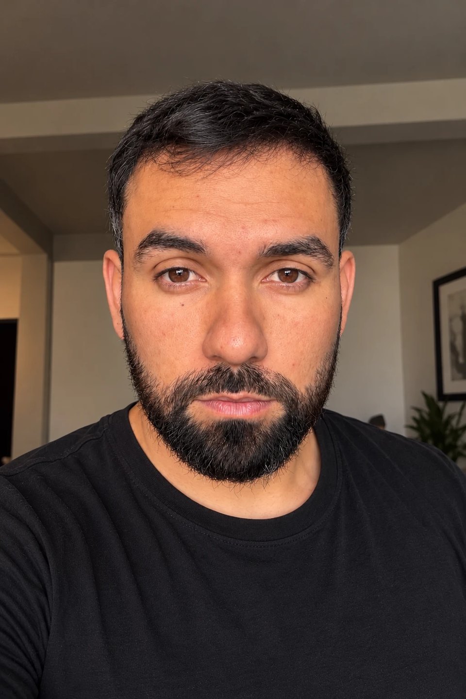 Josué hoy, con el cabello recuperado